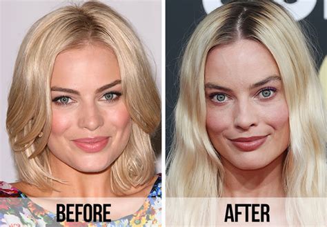 margot robbie before and after surgery|Fans Spot A ‘Huge Difference’ In Margot Robbie’s Appearance After ...